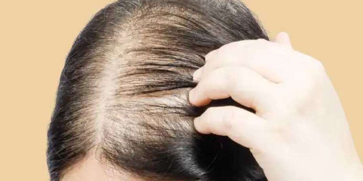 Hair Loss Treatments That You Need to Know in 2025