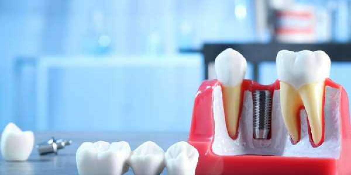 Foods to Avoid During Invisalign Treatment