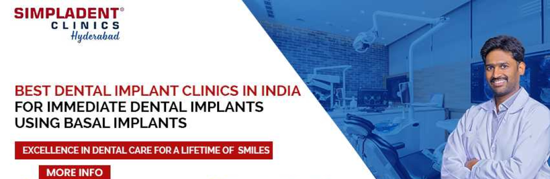 Immediate Loading Dental Implants In Hyderabad Cover Image