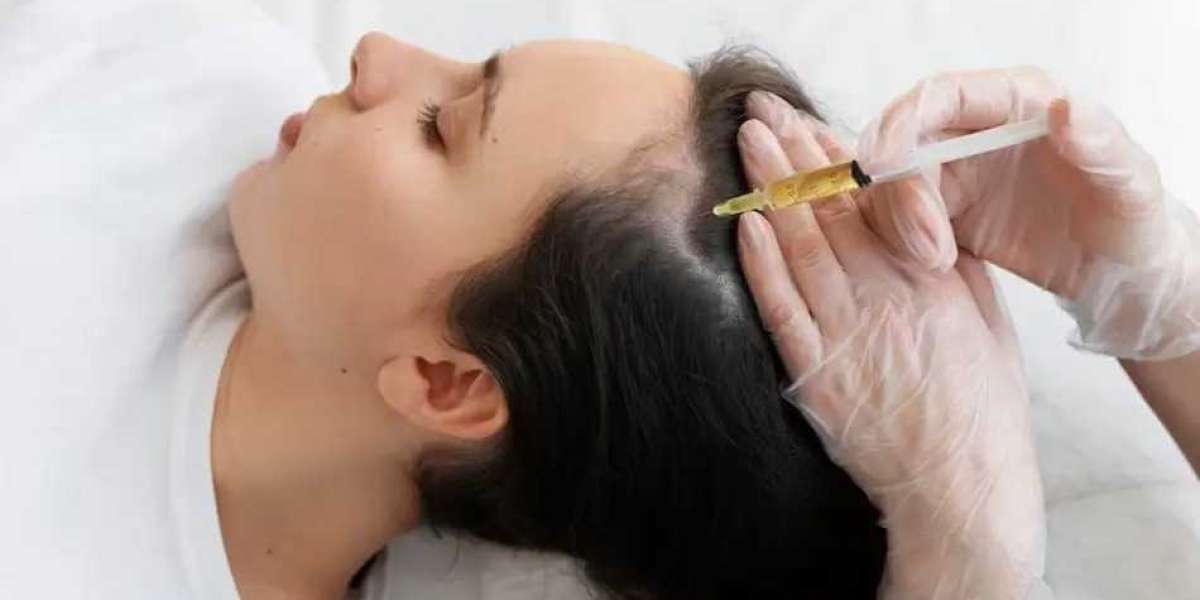 Restore Confidence and Regain Healthy Hair with PRP Hair Treatment in Noida