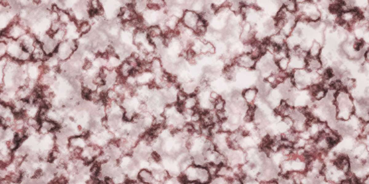 Case Study: Fast $100 Loan With No Credit Check